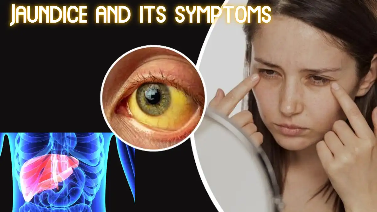 Jaundice and its symptoms